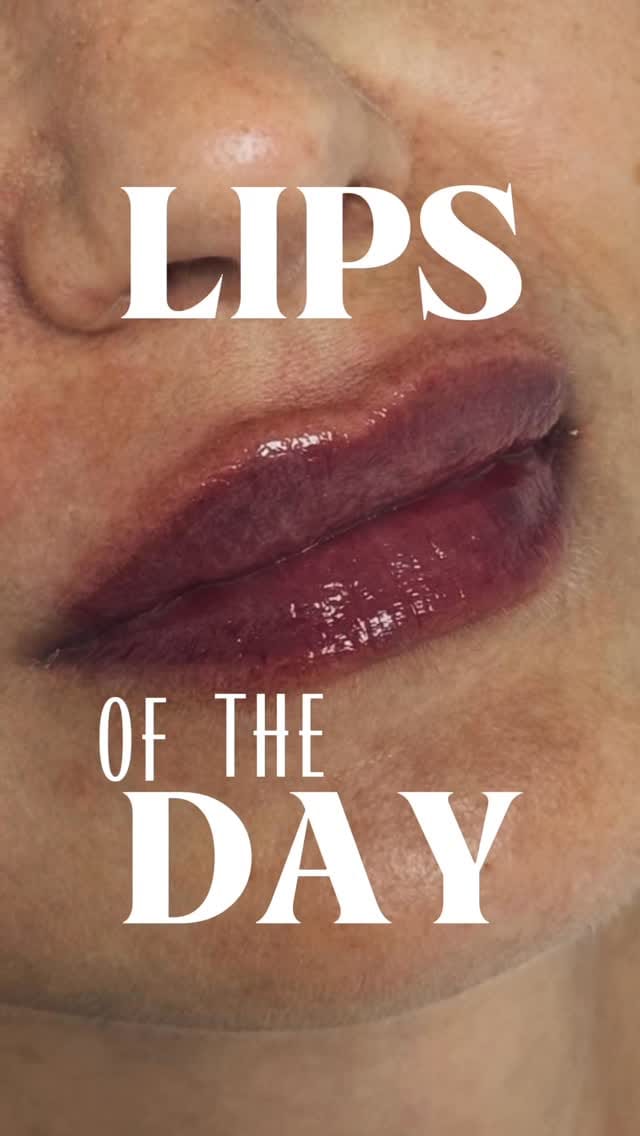 Post 7 by Uzm. Dr. Merve Oruç on Instagram (video)