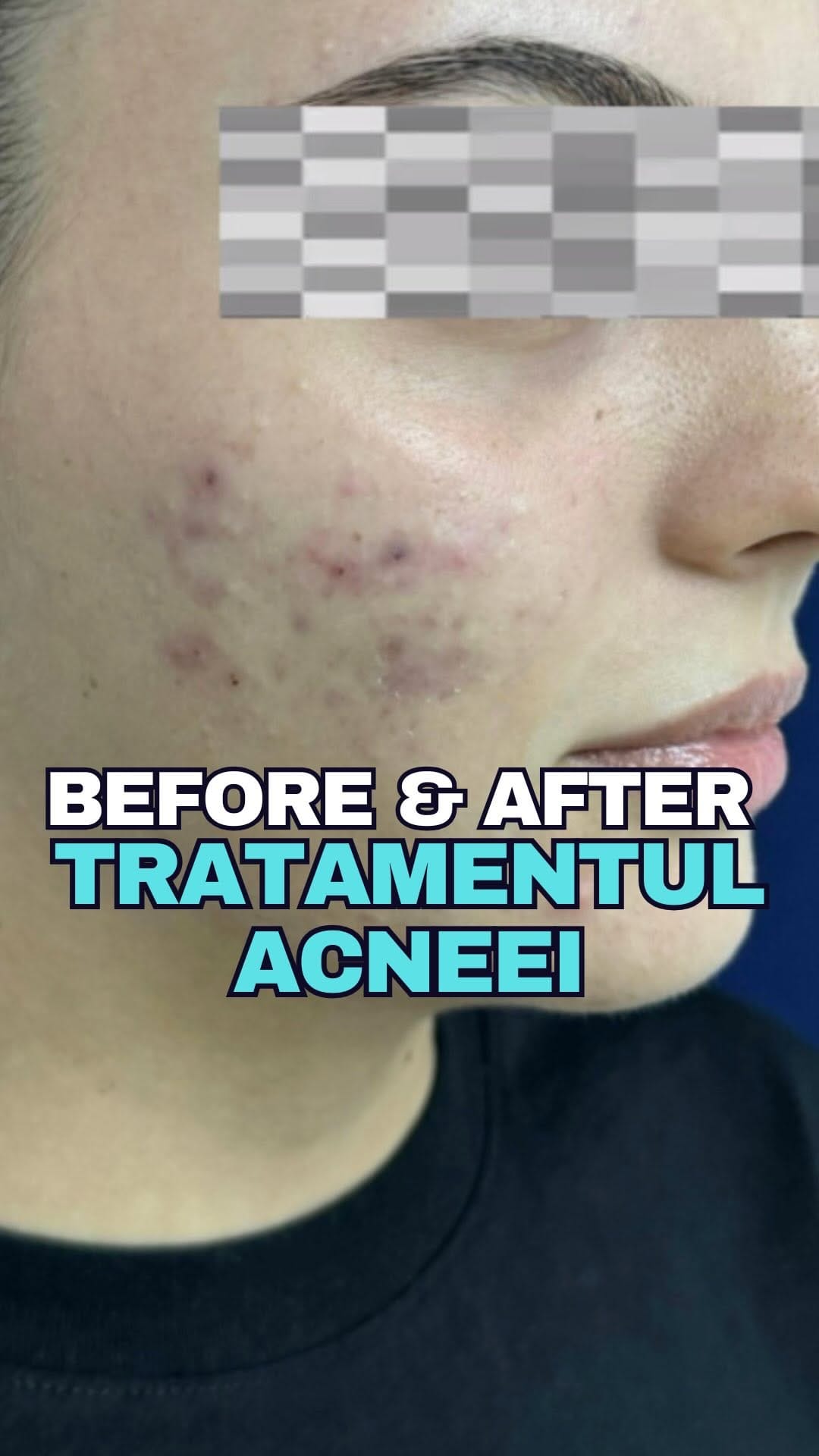 Post 5 by Uzm. Dr. Merve Oruç on Instagram (video)