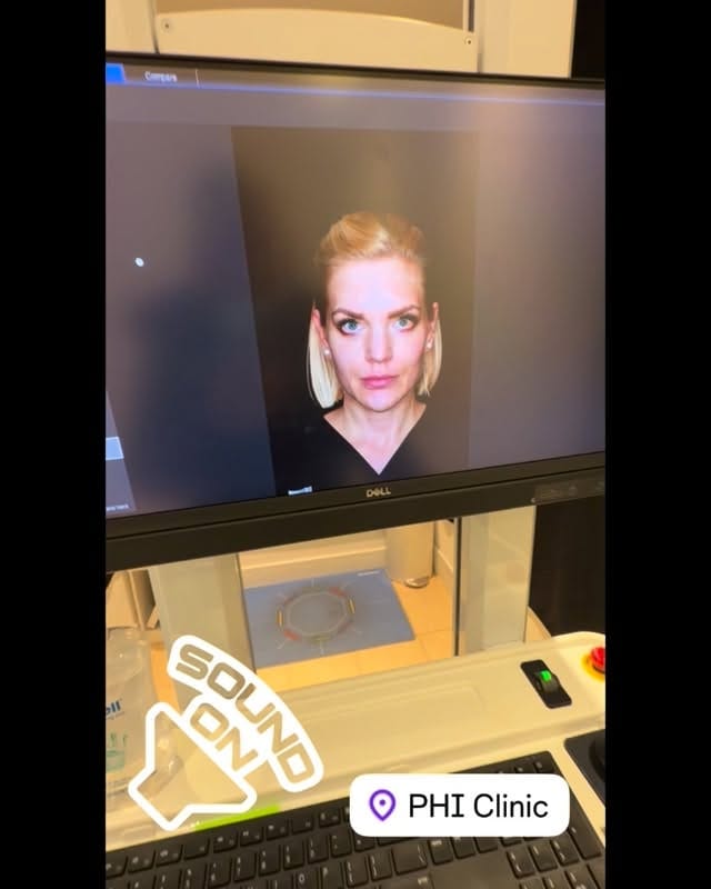 Post 4 by PHI Clinic on Instagram (video)