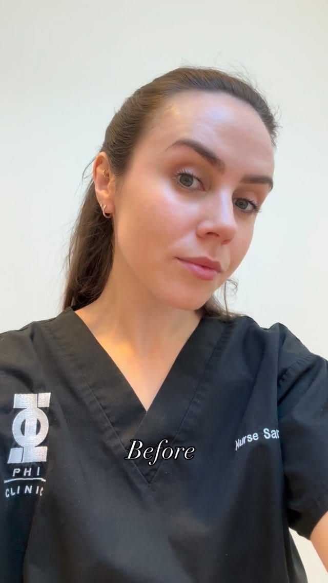 Post 9 by PHI Clinic on Instagram (video)