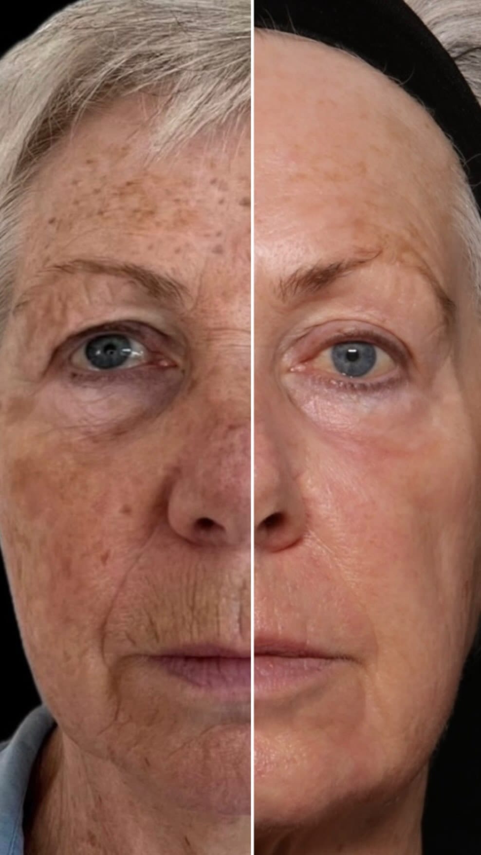Post 10 by PHI Clinic on Instagram (video)
