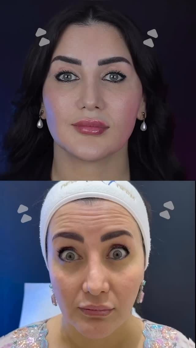 Post 3 by Spanish Center Derma on Instagram (video)