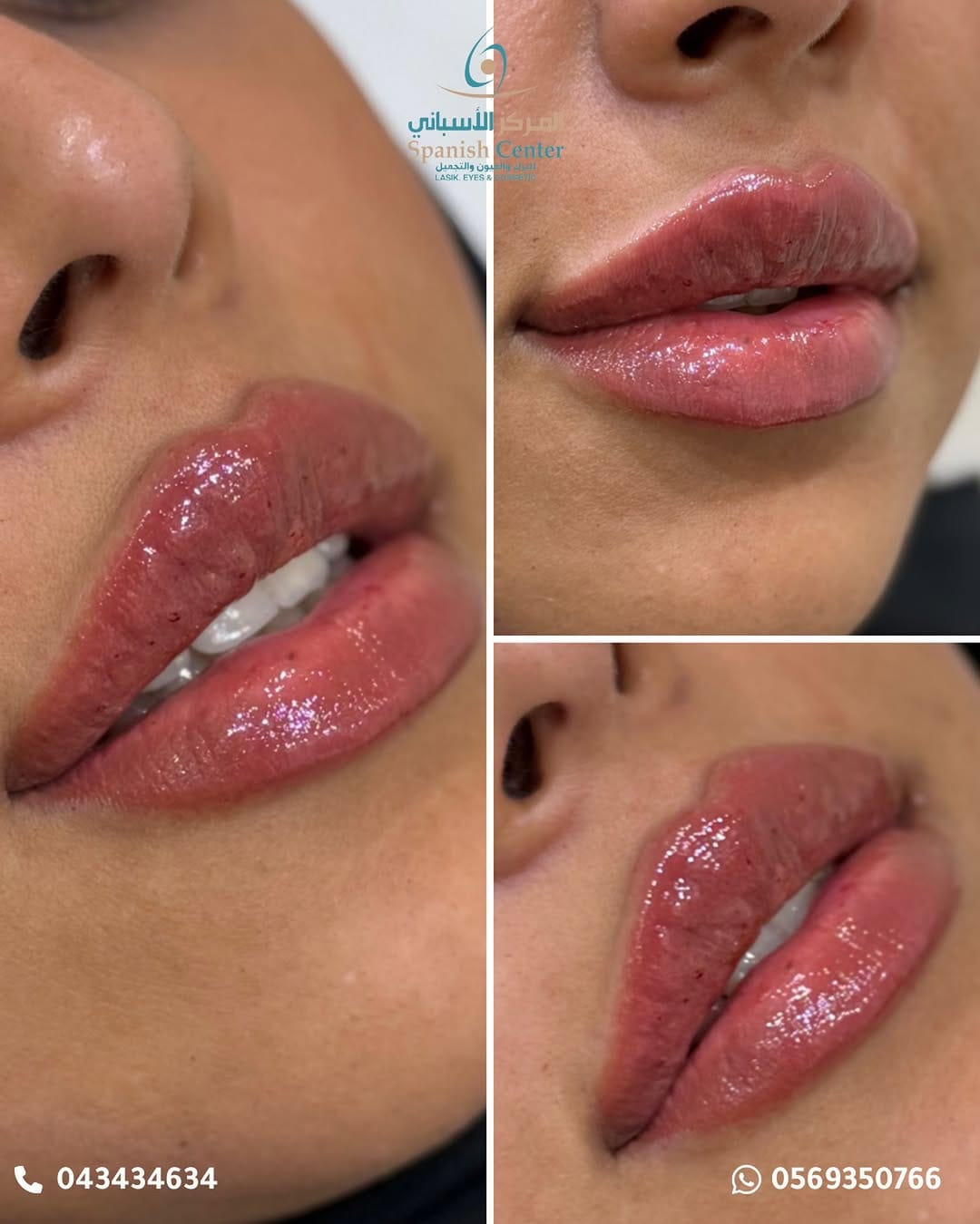 Post 5 by Spanish Center Derma on Instagram (image)