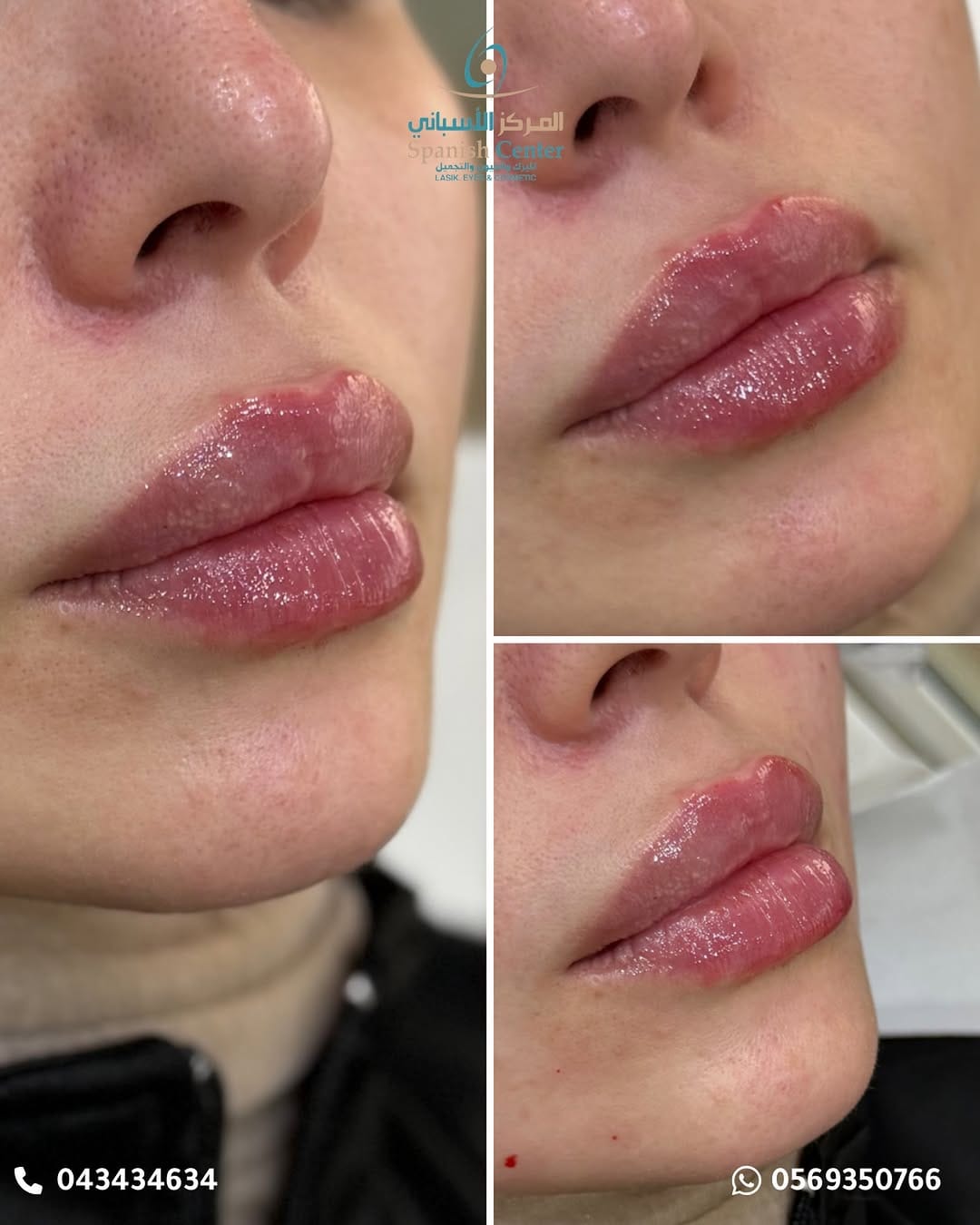Post 6 by Spanish Center Derma on Instagram (image)