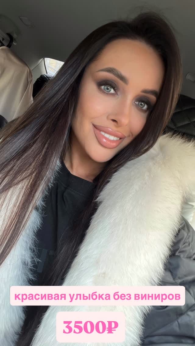 Post 4 by ОТБЕЛИВАНИЕ.ME - №1 магазин 💎 on Instagram (video)