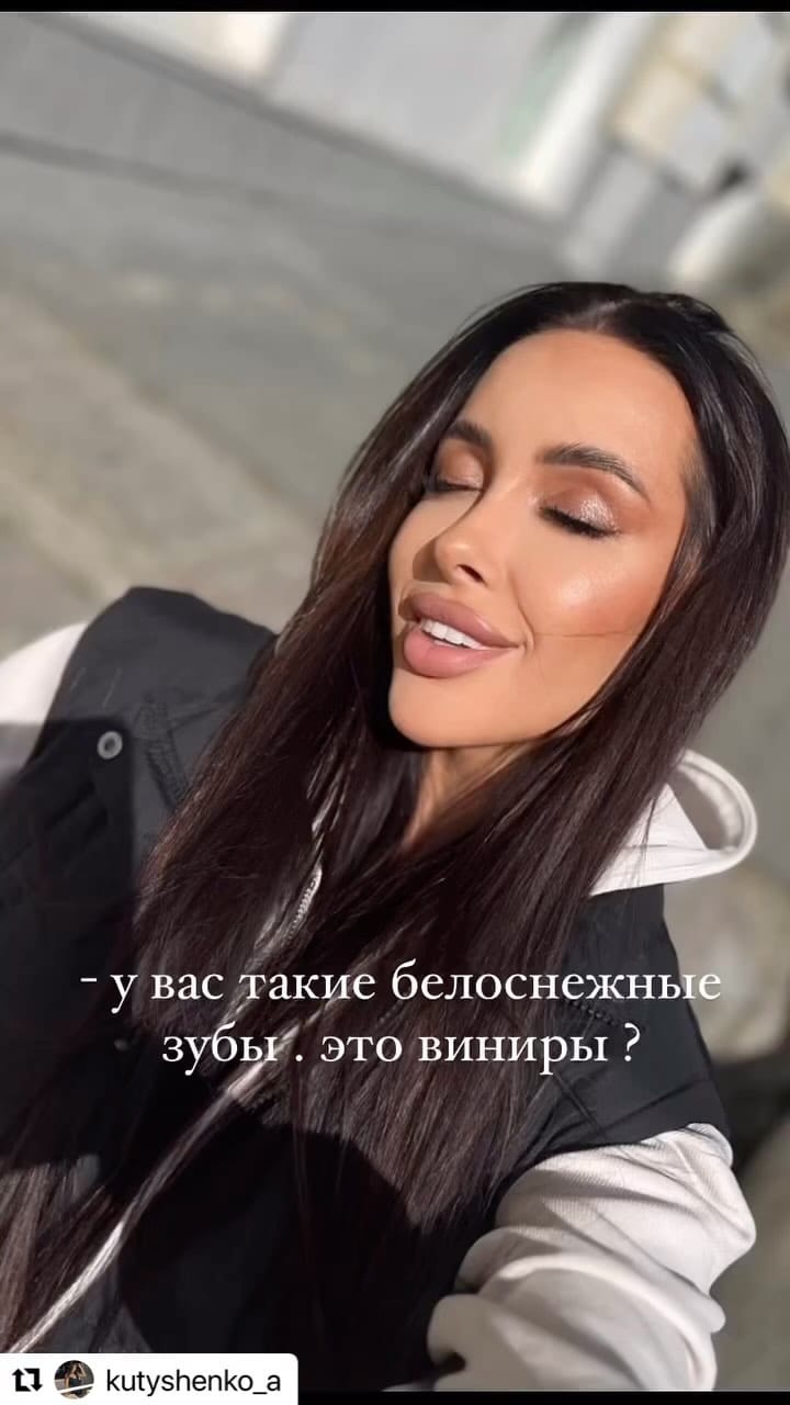Post 10 by ОТБЕЛИВАНИЕ.ME - №1 магазин 💎 on Instagram (video)