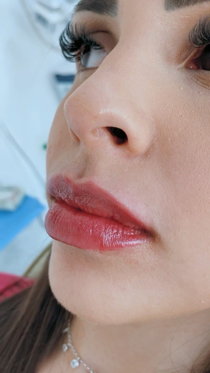 Post 3 by Vinci Aesthetics on Instagram (video)
