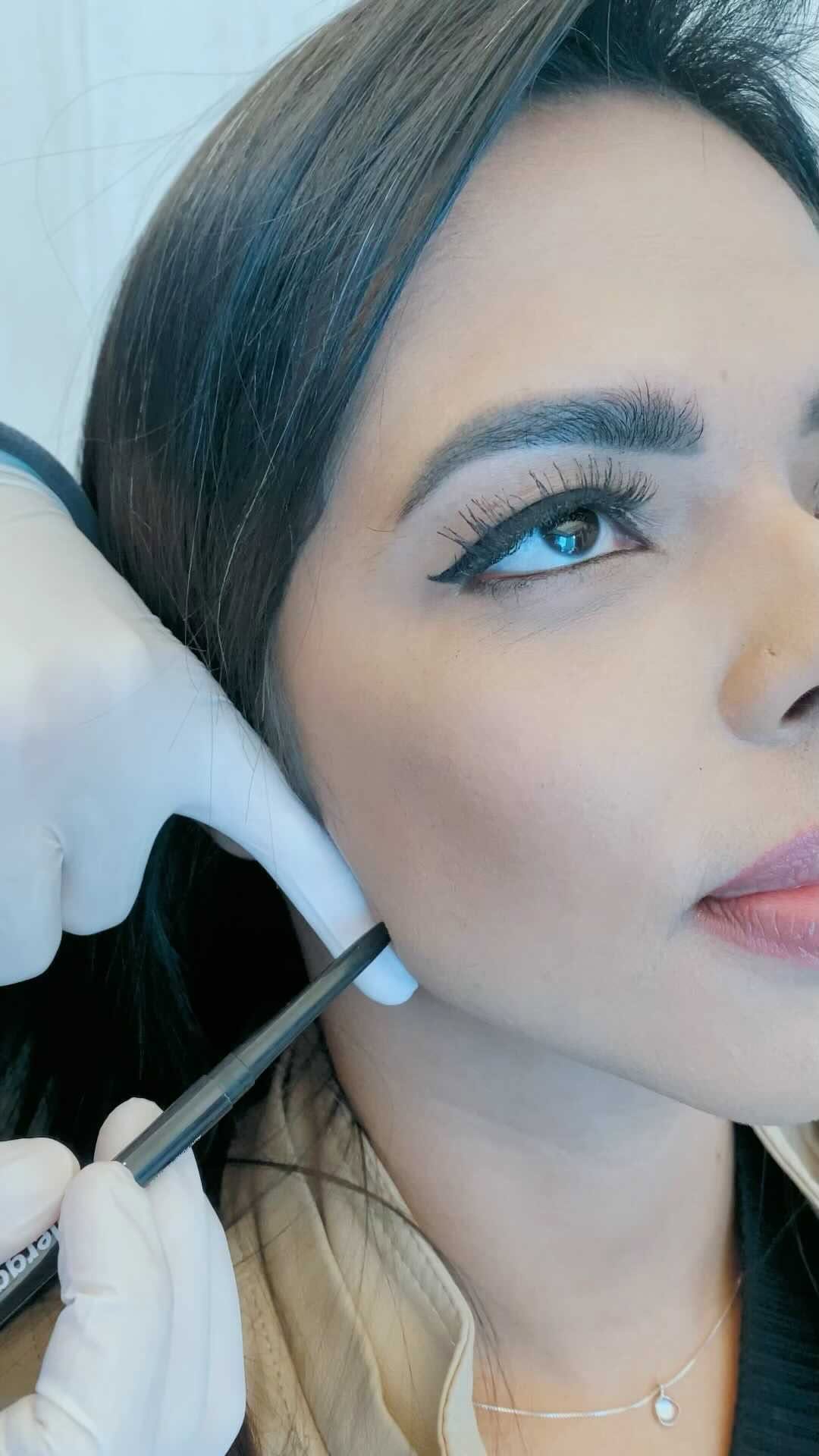 Post 6 by Vinci Aesthetics on Instagram (video)