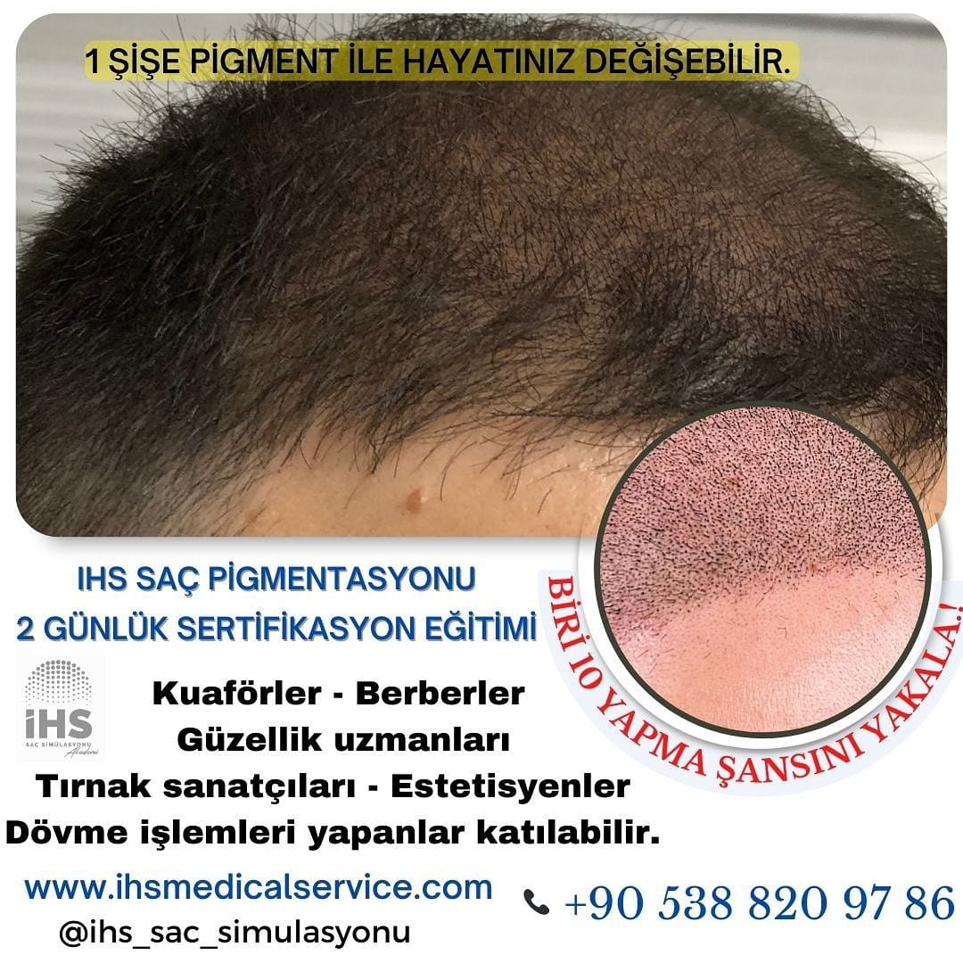 Post 9 by İHS Saç simülasyonu on Instagram (image)