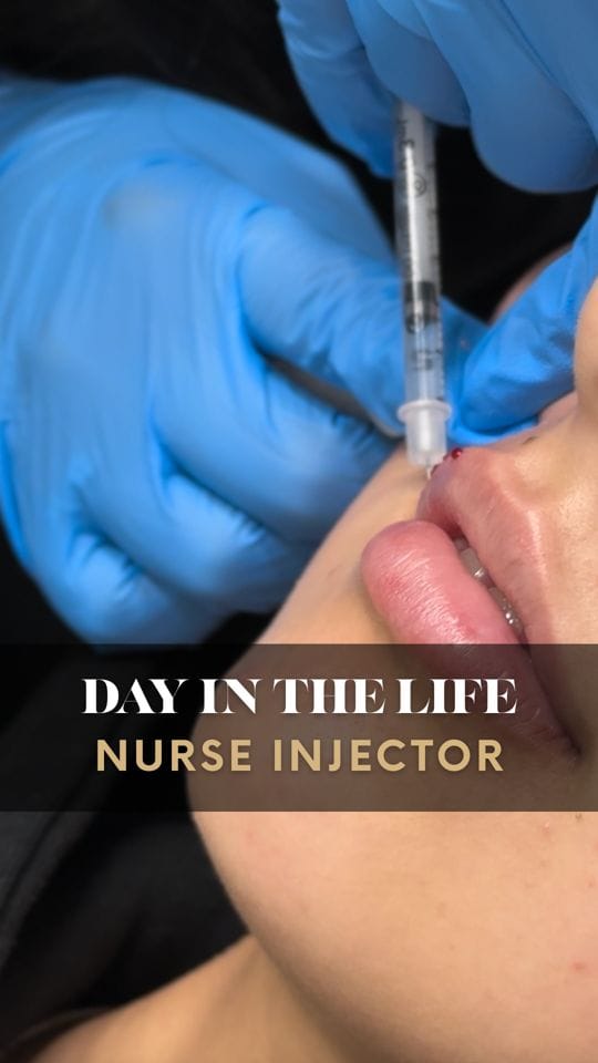 Post 8 by Shafroz RN BN | Botox, Filler, PRP, PRF, microneedling on Instagram (video)