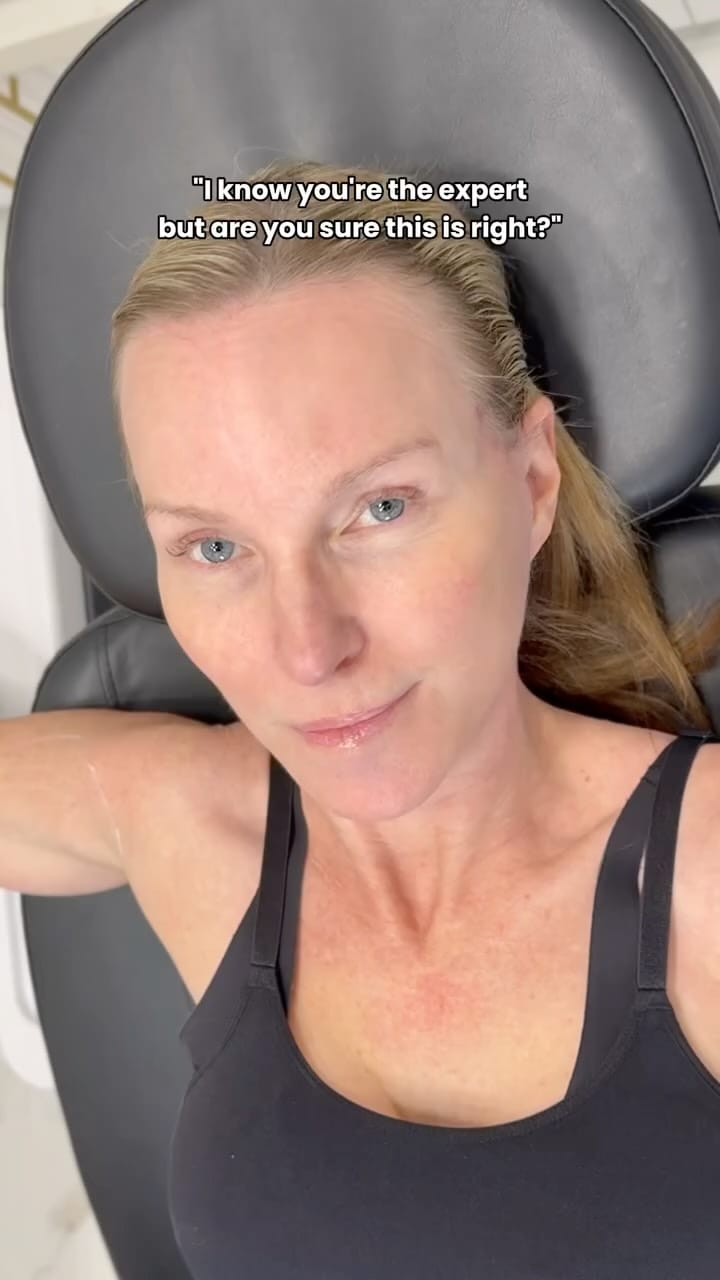 Post 6 by Shafroz RN BN | Botox, Filler, PRP, PRF, microneedling on Instagram (video)