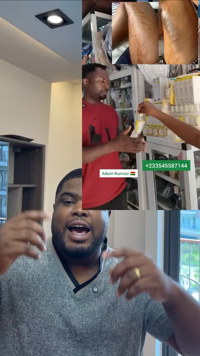 Post 3 by NO1 STRETCH MARK PRODUCTS on Instagram (video)