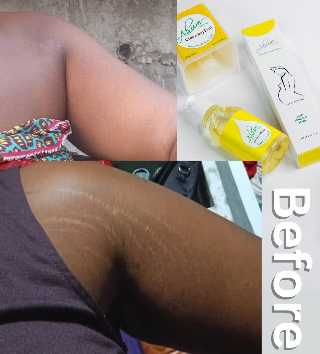Post 4 by NO1 STRETCH MARK PRODUCTS on Instagram (image)