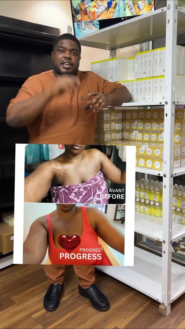 Post 9 by NO1 STRETCH MARK PRODUCTS on Instagram (video)