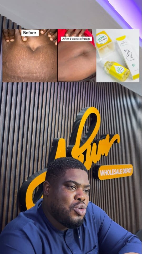 Post 7 by NO1 STRETCH MARK PRODUCTS on Instagram (video)