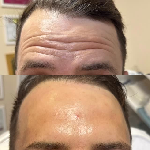 Post 10 by Marcia kochinski  Biomédica Esteta on Instagram (video)
