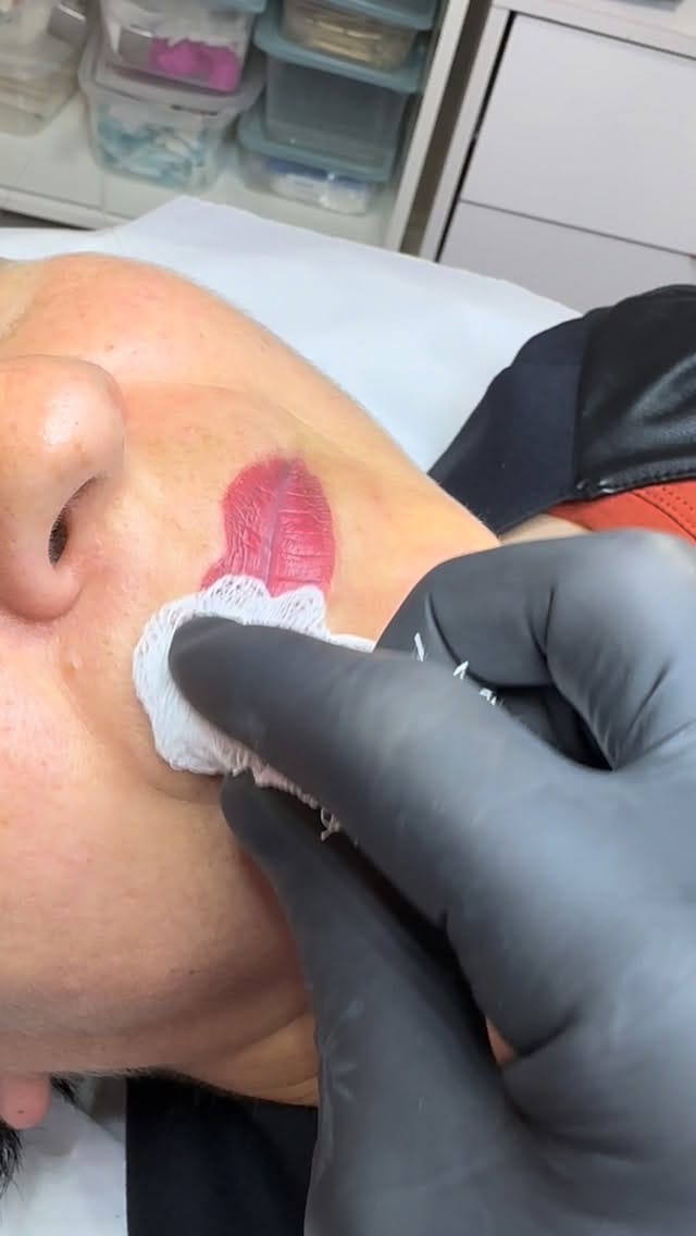 Post 5 by Marcia kochinski  Biomédica Esteta on Instagram (video)