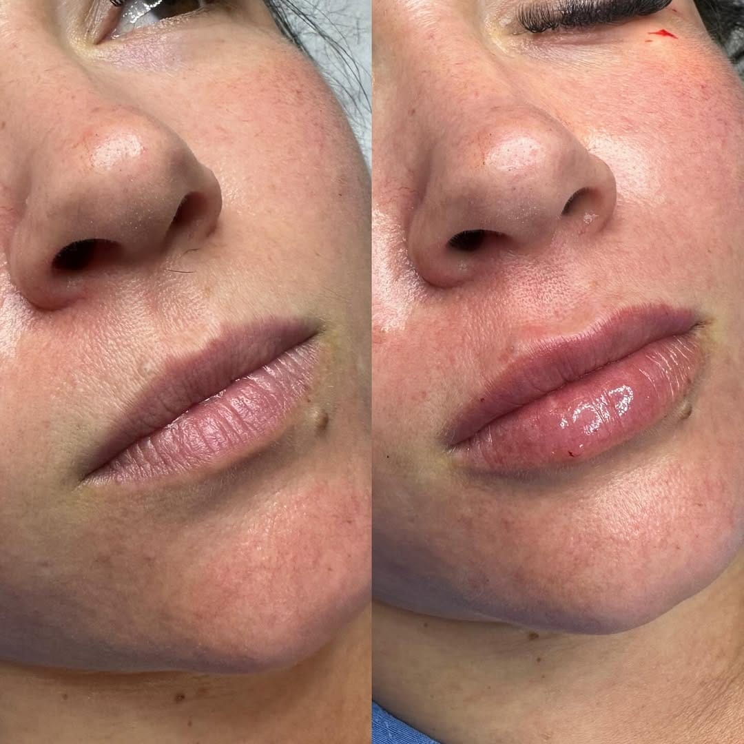 Post 7 by Marcia kochinski  Biomédica Esteta on Instagram (image)