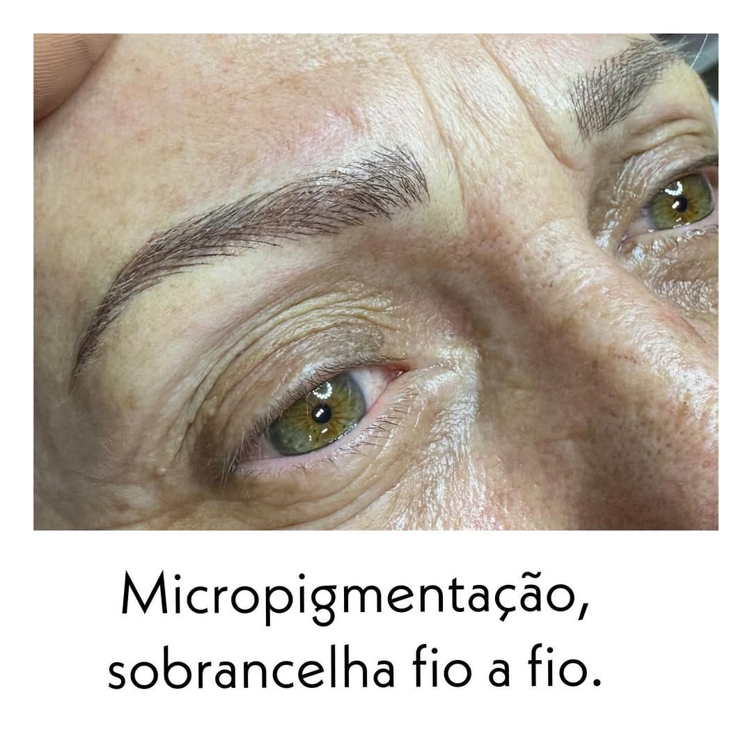 Post 3 by Marcia kochinski  Biomédica Esteta on Instagram (image)