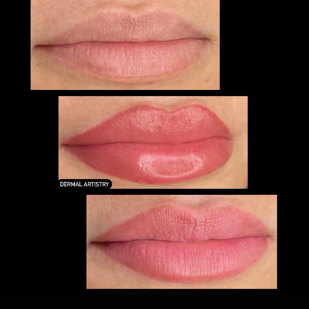 Post 8 by Dermal Artistry on Instagram (image)