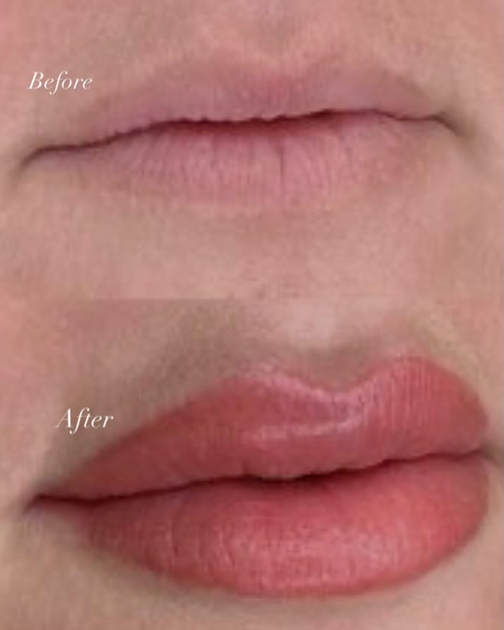 Post 1 by Dermal Artistry on Instagram (image)