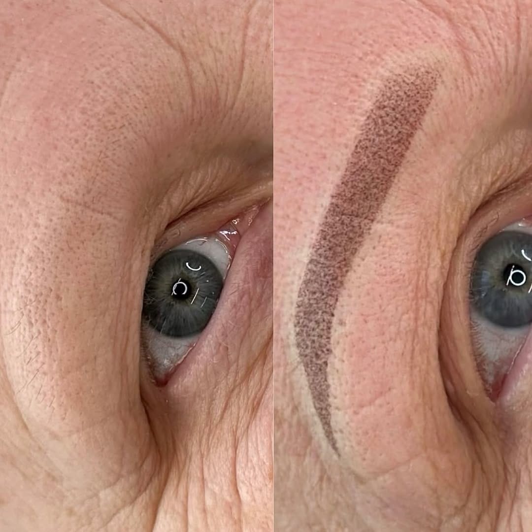 Post 6 by Dermal Artistry on Instagram (image)