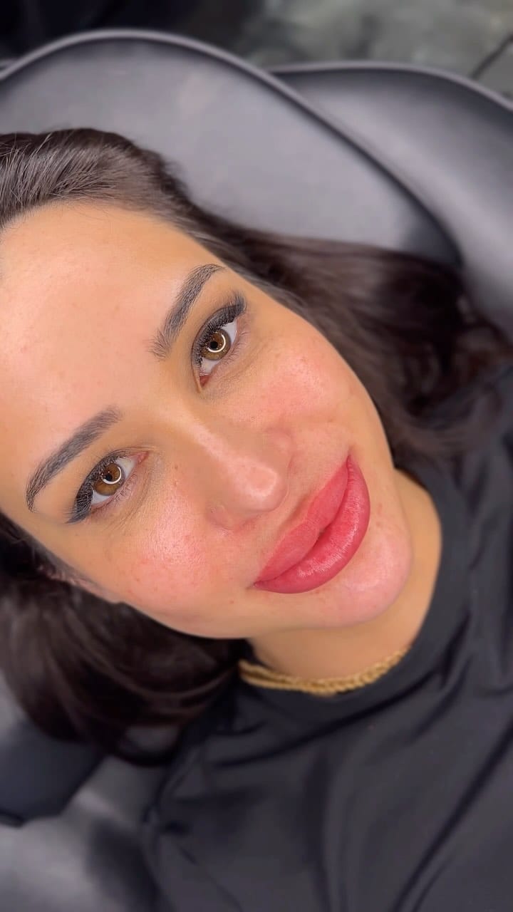 Post 9 by Poliana Bertunes | Remoção Tatuagem a Laser em SP on Instagram (video)