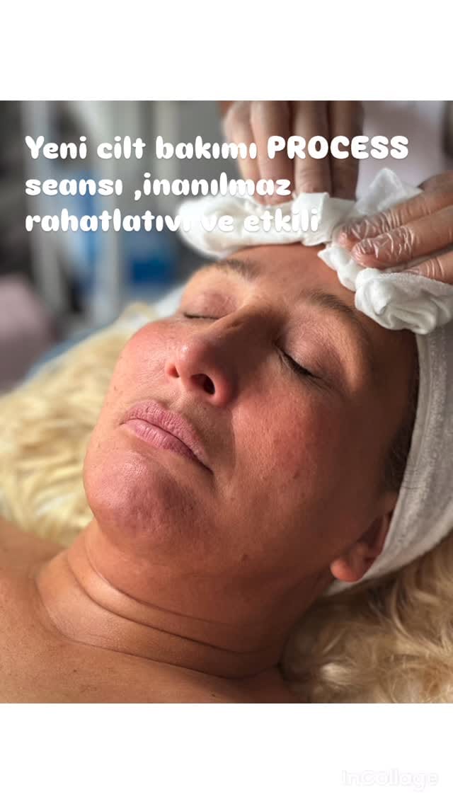 Post 10 by Özlem Özgün Estetik on Instagram (video)