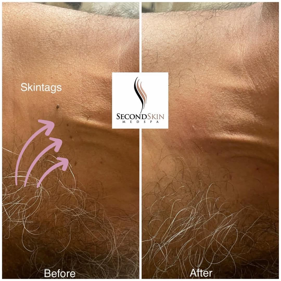 Post 1 by Second Skin Medspa on Instagram (image)