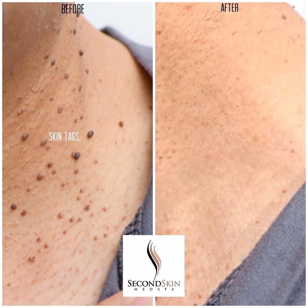 Post 3 by Second Skin Medspa on Instagram (image)