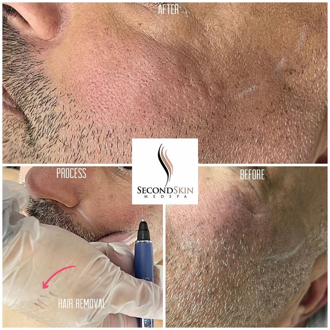 Post 10 by Second Skin Medspa on Instagram (image)