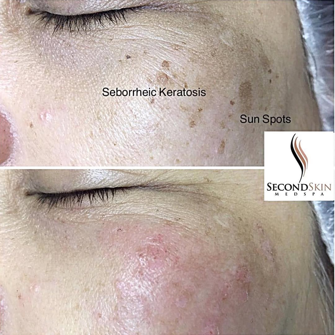 Post 9 by Second Skin Medspa on Instagram (image)