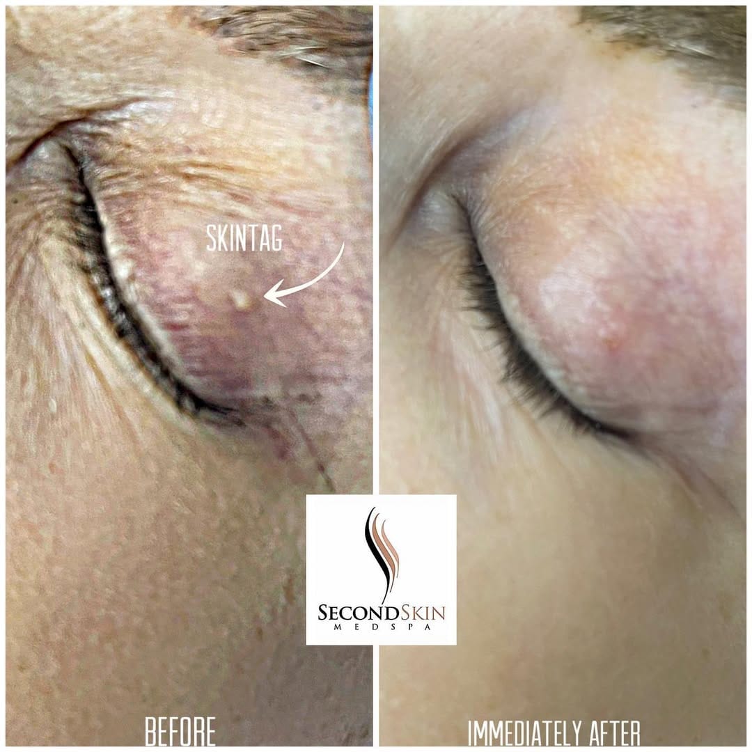 Post 7 by Second Skin Medspa on Instagram (image)