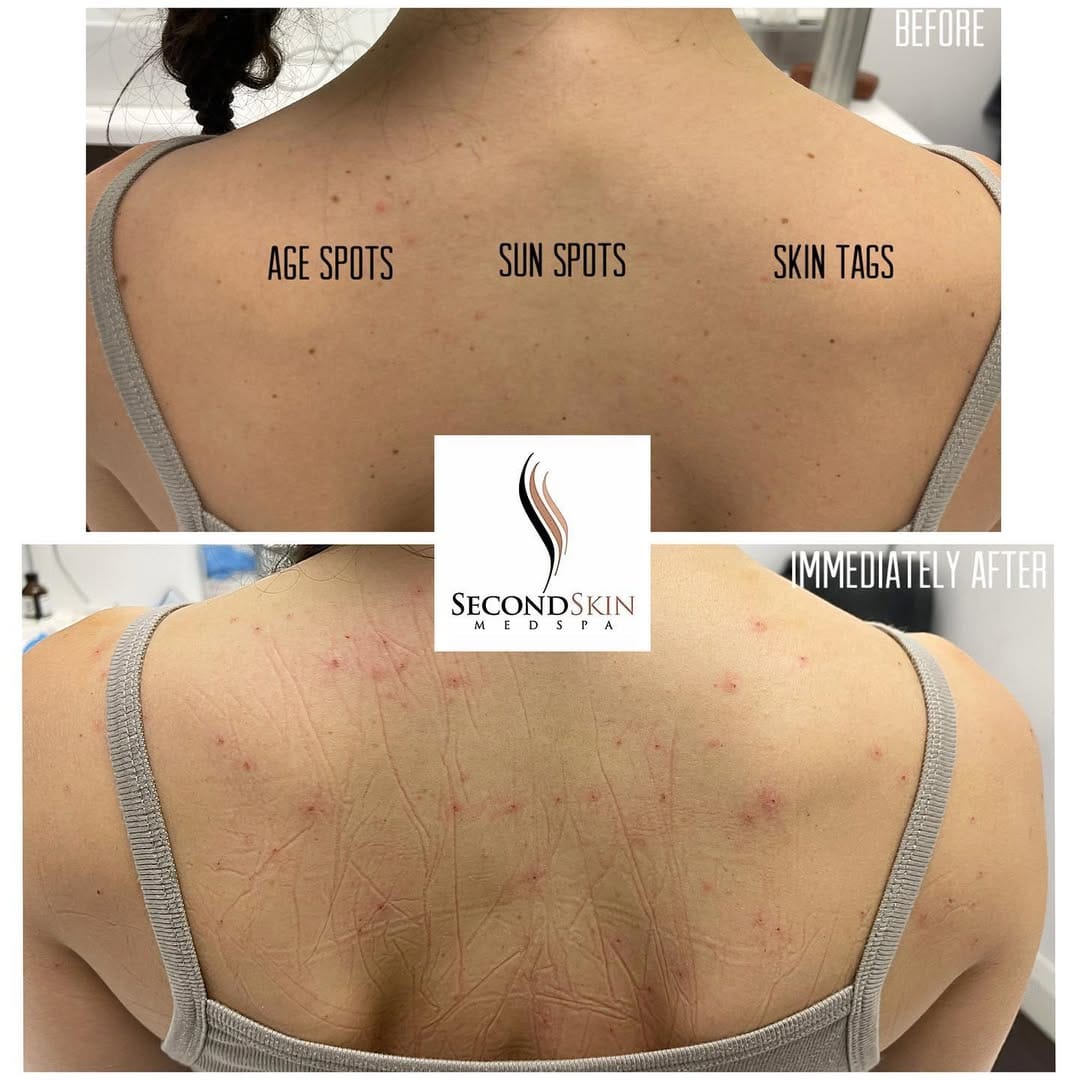 Post 2 by Second Skin Medspa on Instagram (image)