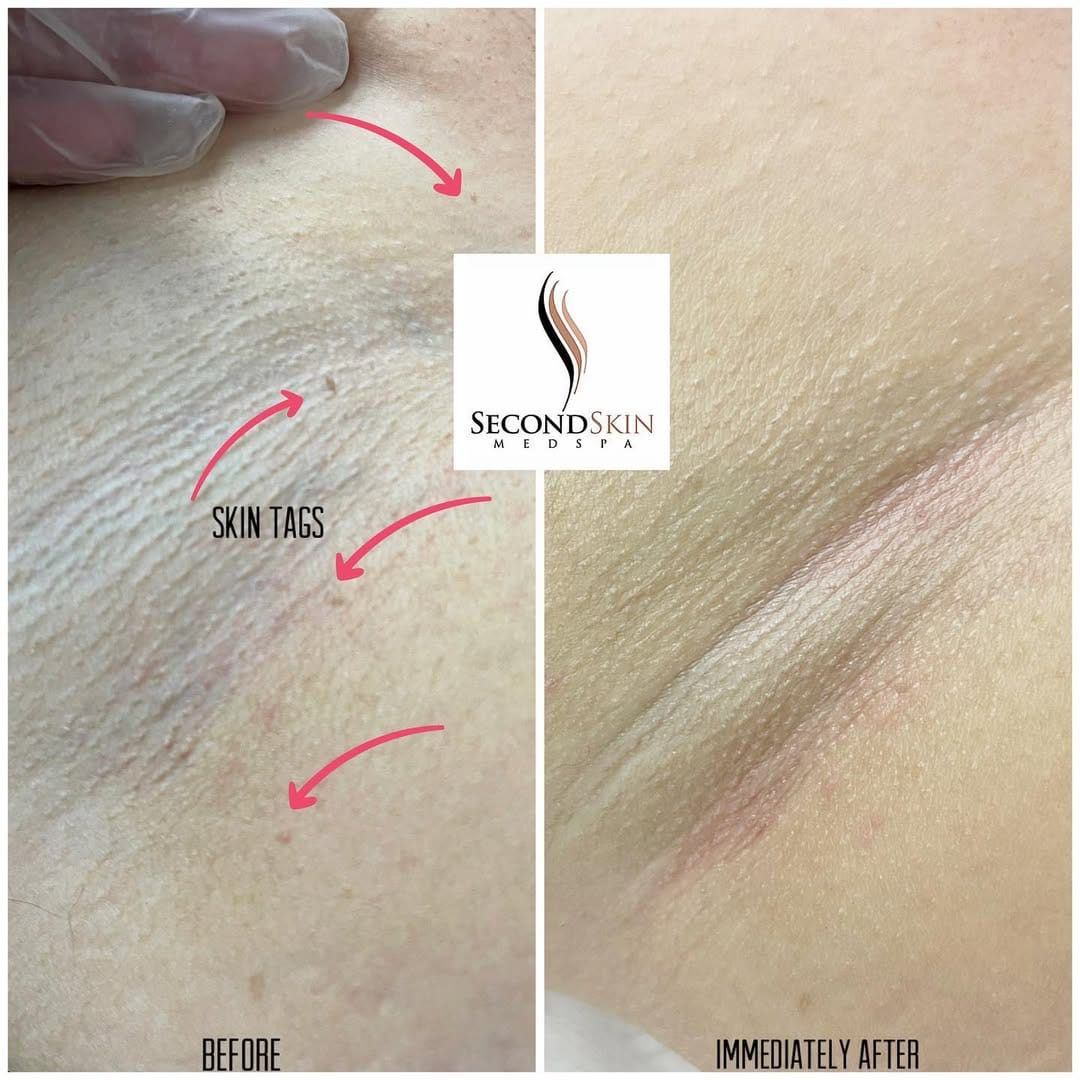 Post 4 by Second Skin Medspa on Instagram (image)