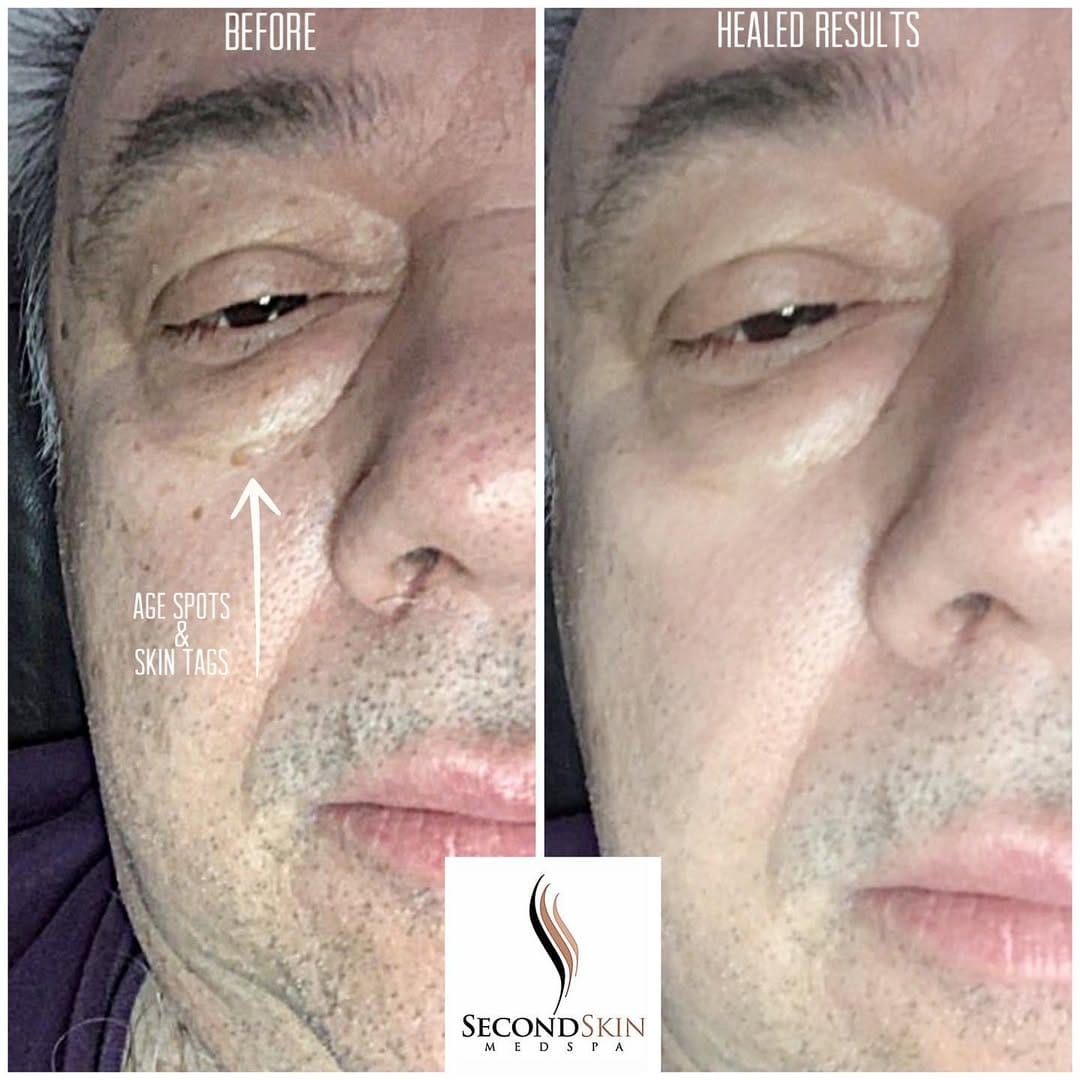 Post 6 by Second Skin Medspa on Instagram (image)
