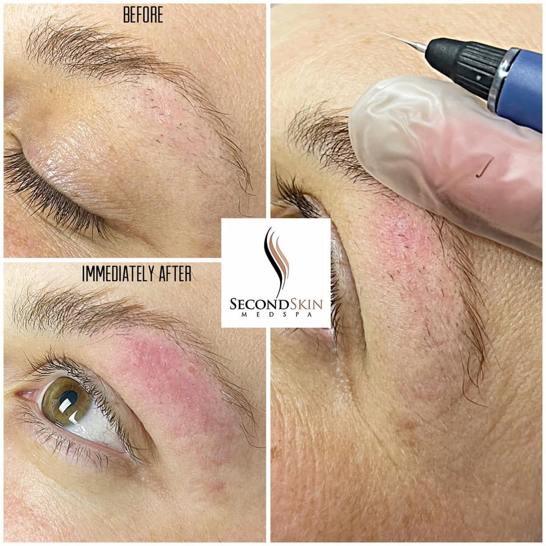 Post 5 by Second Skin Medspa on Instagram (image)