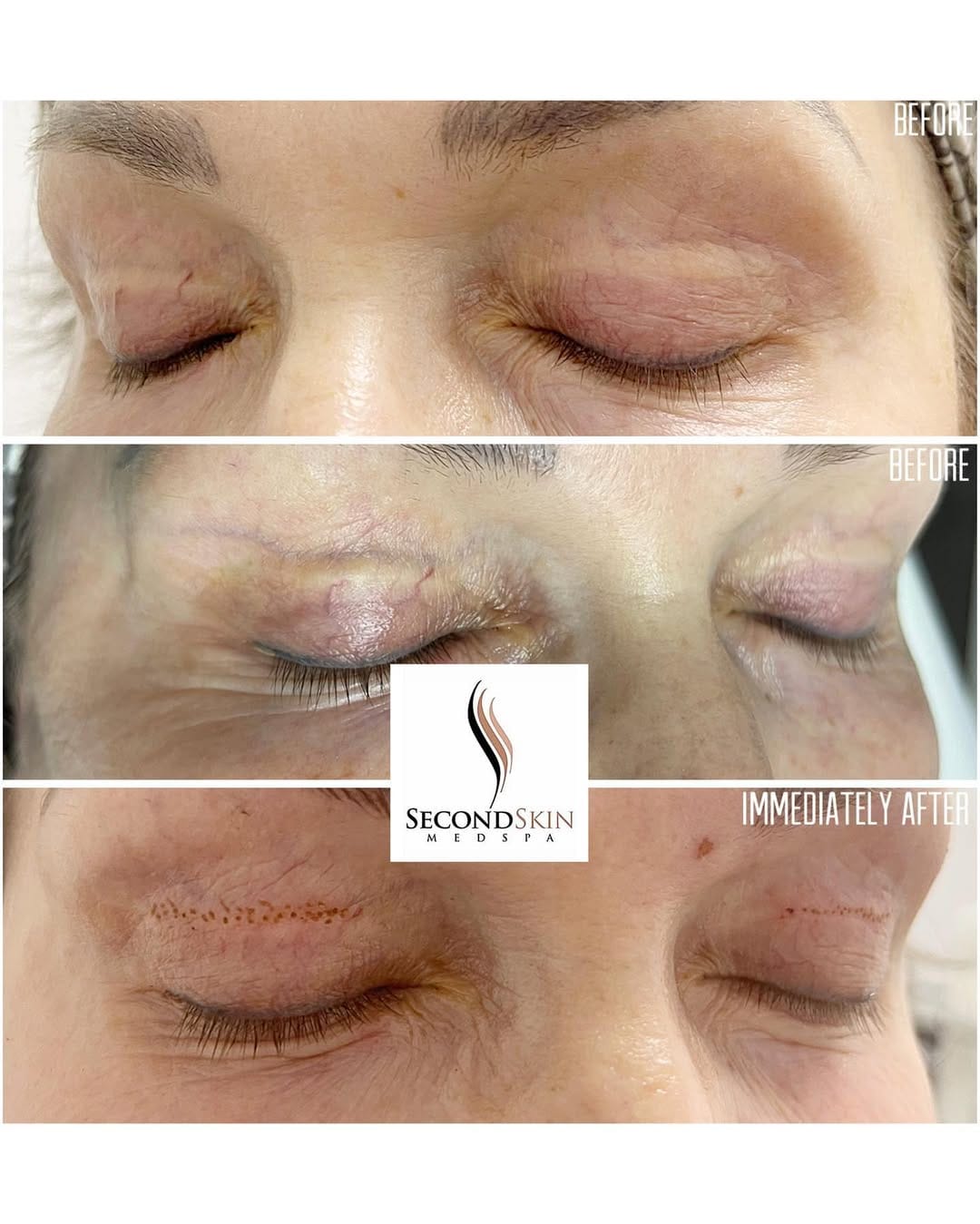 Post 8 by Second Skin Medspa on Instagram (image)