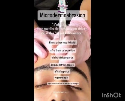 Post 7 by Centro Medico Estético on Instagram (video)