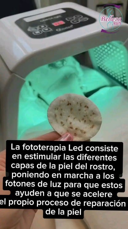 Post 4 by Centro Medico Estético on Instagram (video)