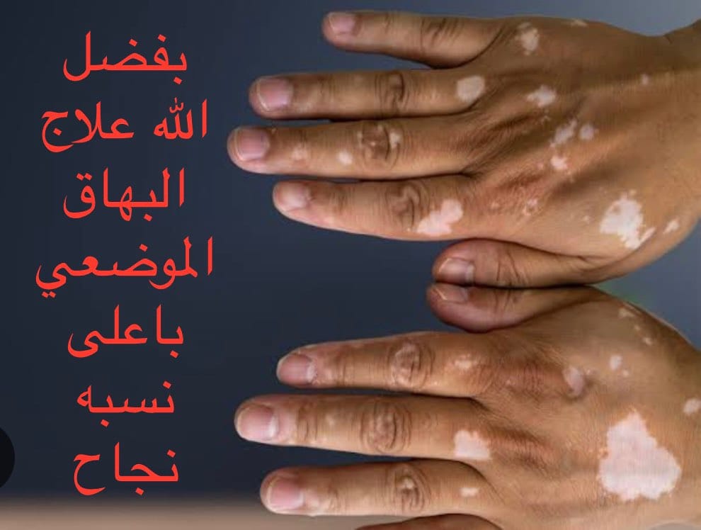 Post 9 by Drmohamed Abdelbary on Instagram (image)