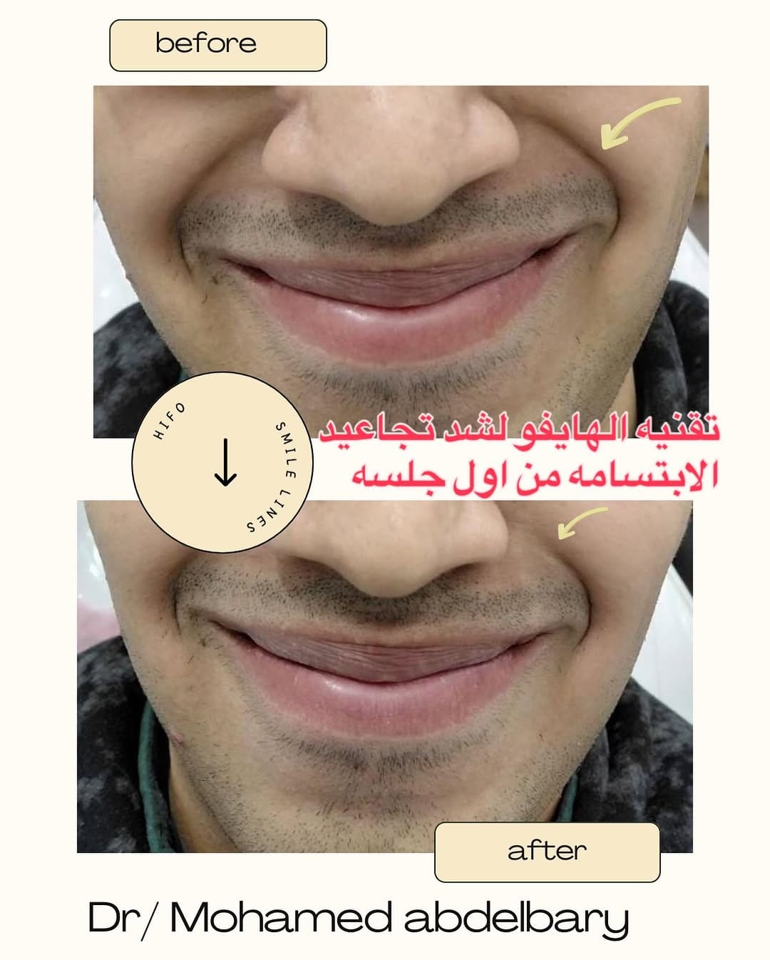 Post 2 by Drmohamed Abdelbary on Instagram (image)