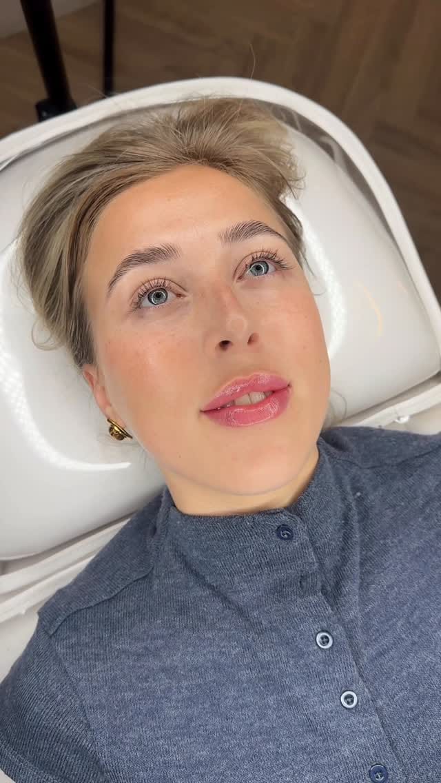 Post 2 by @charlies_angels_aesthetics on Instagram (video)