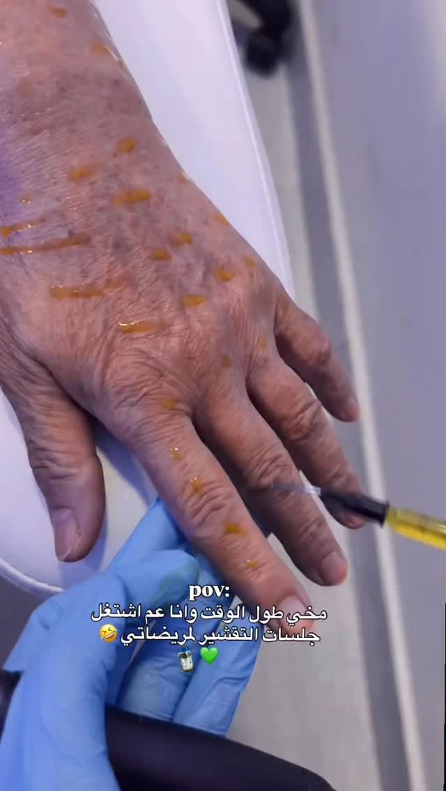 Post 7 by Value Aesthetic Medical Supplier on Instagram (video)