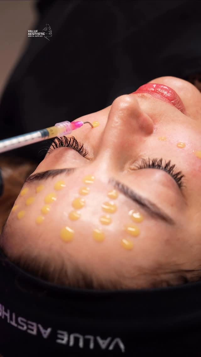 Post 4 by Value Aesthetic Medical Supplier on Instagram (video)