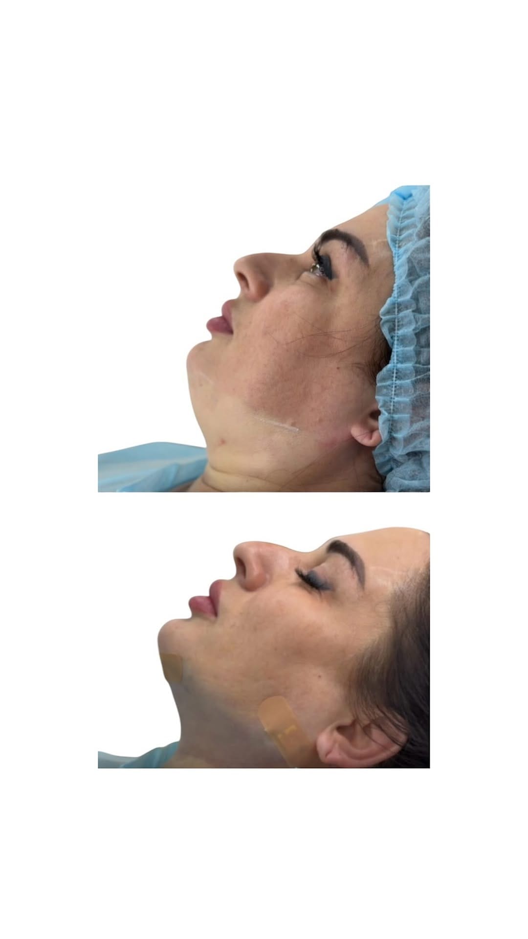 Post 6 by Dr.JEINA | Врач - КОСМЕТОЛОГ ЖЕЙНА 💉 ШЫМКЕНТ | АЛМАТЫ | ДУБАЙ on Instagram (video)