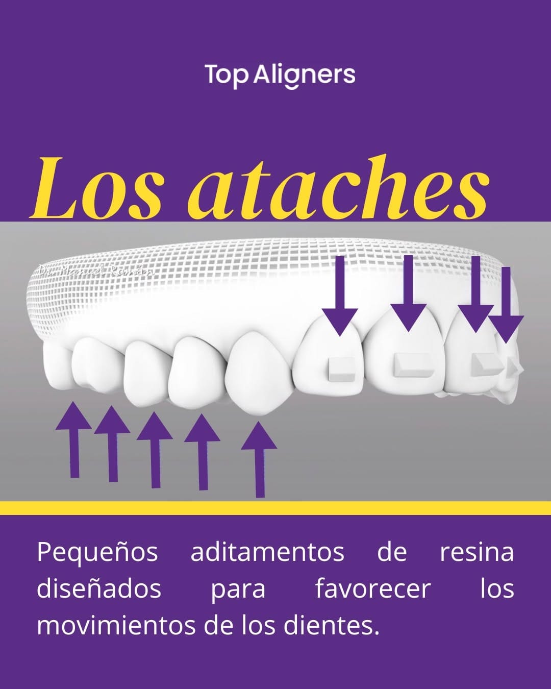 Post 1 by Top Aligners | Alineadores invisibles on Instagram (image)