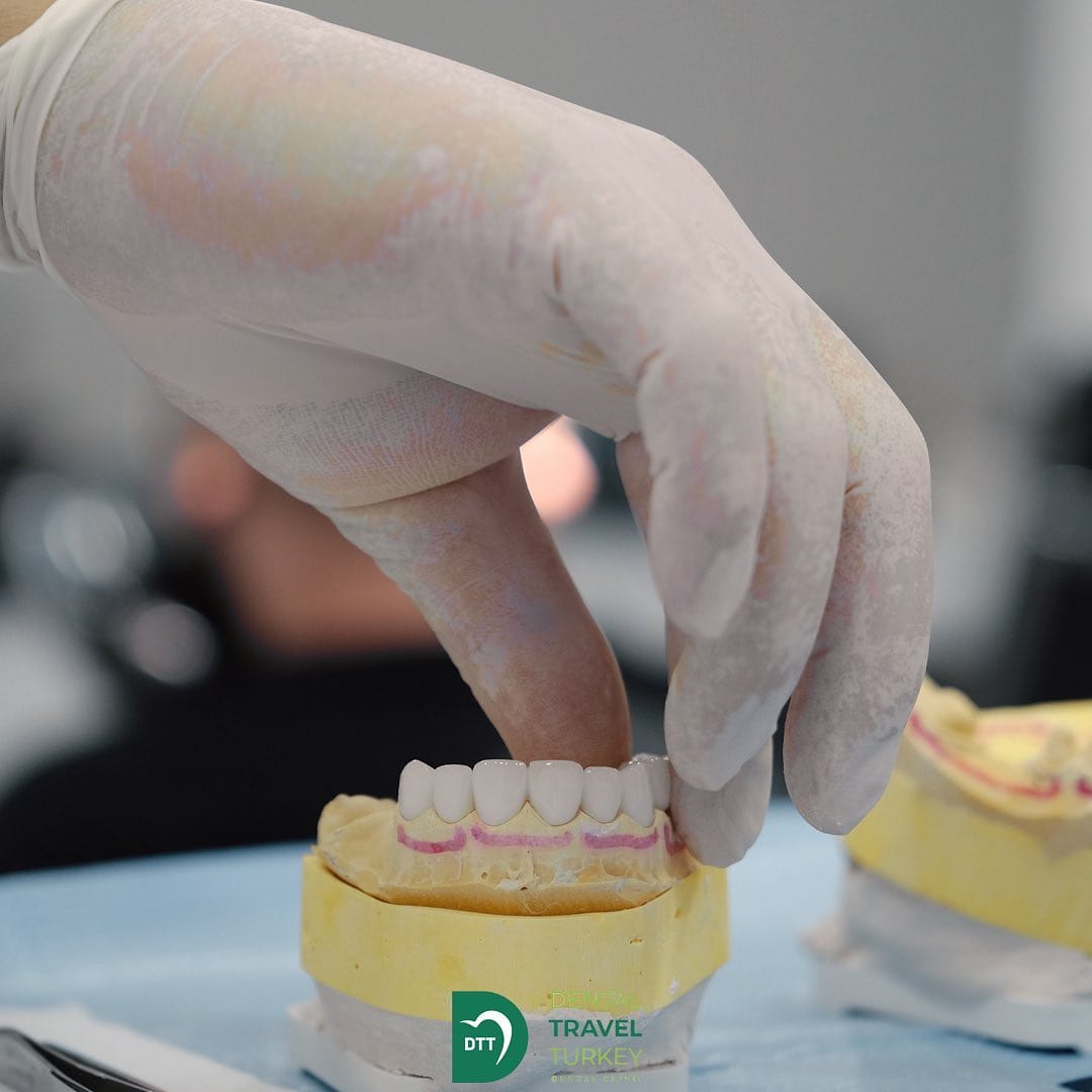 Post 8 by Dental Travel Turkey on Instagram (image)