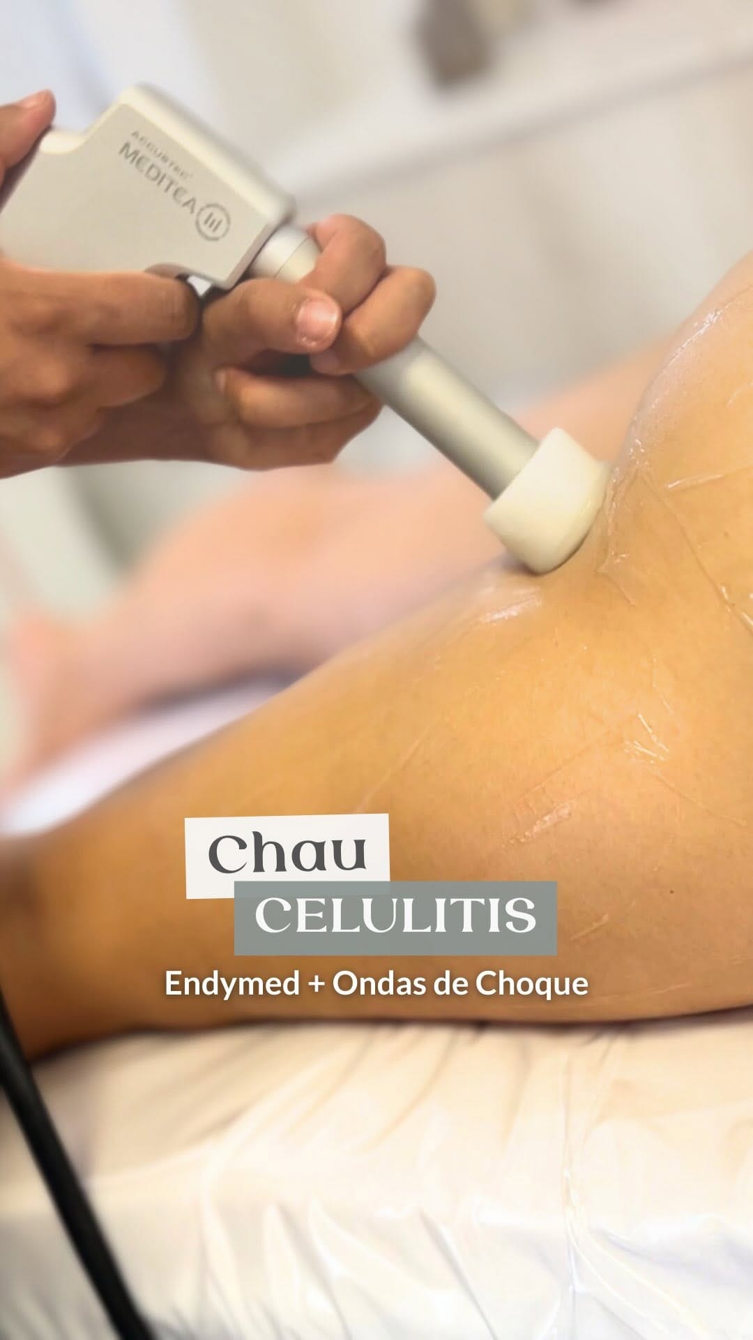 Post 9 by DepilCare | Salud & Estética Neuquén on Instagram (video)