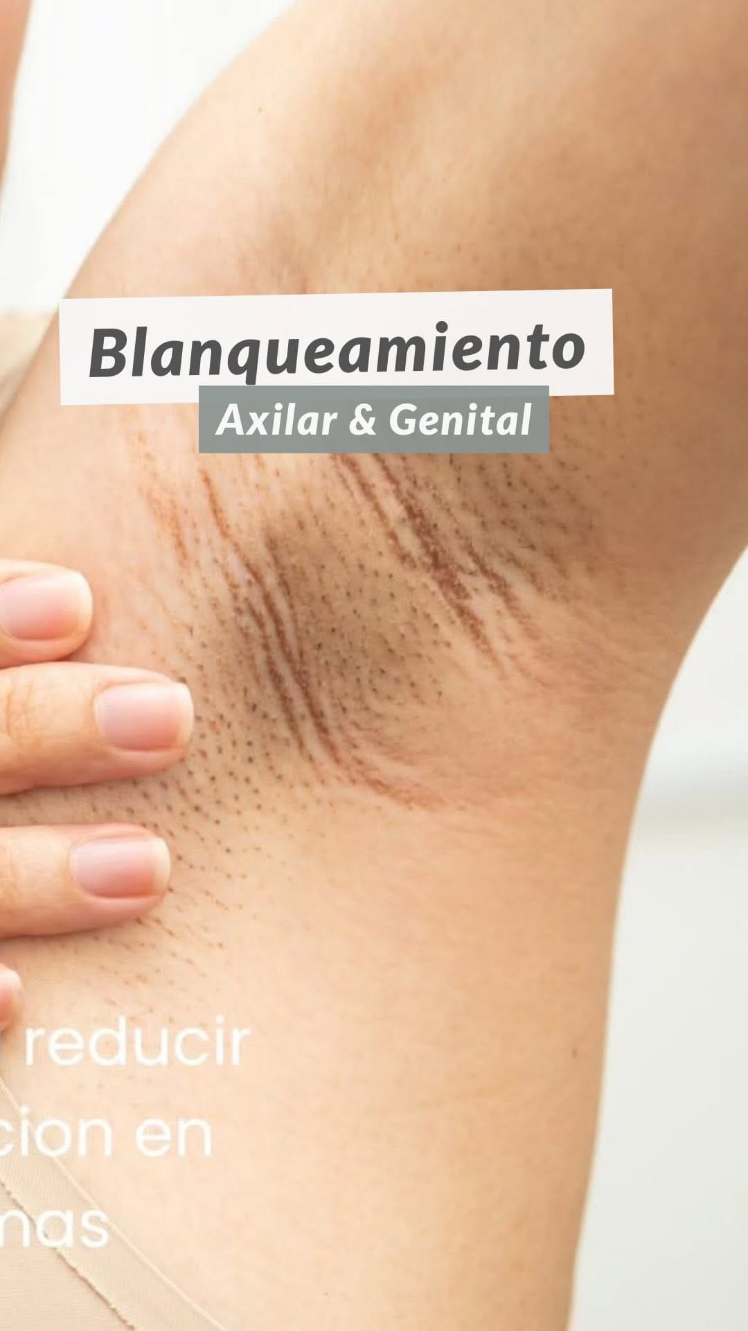Post 2 by DepilCare | Salud & Estética Neuquén on Instagram (video)